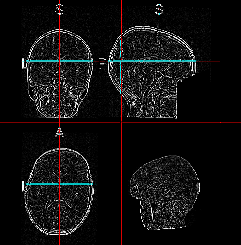 LAPLACE Edge Detection